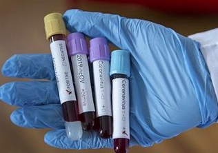 COVID-19: Ghana To Start Daily Testing From May 7