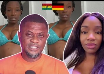 I cut off 80% of my stomach to lose weight, My four surgeries cost  ₵132,000 – Lady  reveals